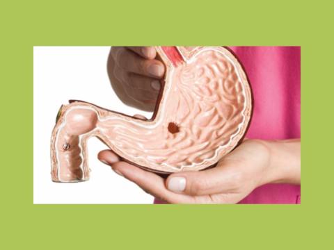 Farmacotherapie na bariatrische chirurgie